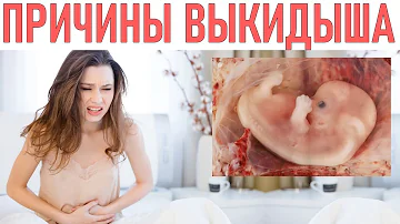 ПРИЧИНЫ ВЫКИДЫША | Когда и из за чего может случиться выкидыш