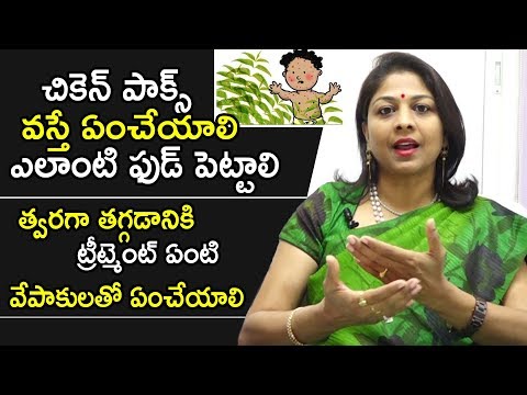 చికెన్ పాక్స్ వస్తే ఎలాంటి ఫుడ్ పెట్టాలి, ట్రీట్మెంట్ ఏంటి, వేపాకులతో ఏంచేయాలి | Dr.Shilpi Tips