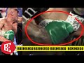 TYSON FURY GLOVEGATE 2.0, FURY'S GLOVES LOOK CRAZY VS DEONTAY WILDE 2