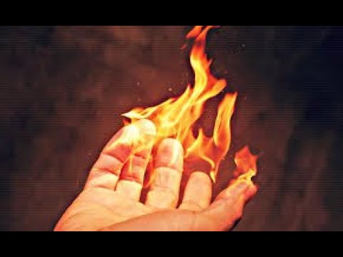Пересадка кожи ожоговым больным. Лечение ожогов 3 степени. Пластическая операция.