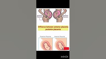 Difference between anterior placenta posterior placenta | #anterior | #posterior