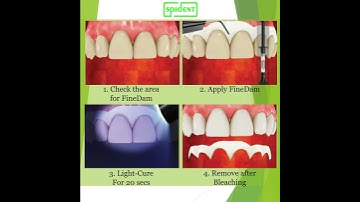 [SPIDENT] 2020 FineDam - Product Introduction