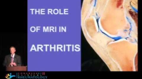 The Roles of MRI in Arthritis - Clyde Helms, MD