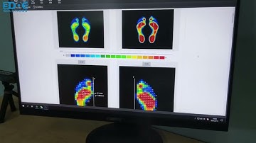 3DOE eWay gait plantar pressure test and analysis system demonstration video