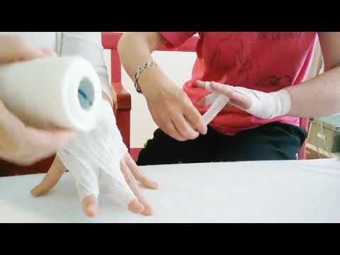 Video: Cómo vendar los dedos de las manos o de los pies: Comprobación de roturas + Consejos de primeros auxilios