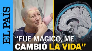 Ciencia Una Técnica De Ultrasonidos Focalizados Logra Eliminar Síntomas Del Parkinson El País