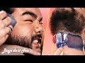 Men Try Beard Waxing For The First Time - No More Shaving!!