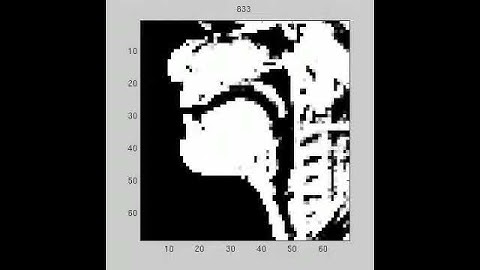 Enhanced MR image for robust image processing