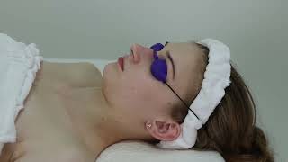 CO2 FRACTIONAL LASER FOR SKIN REJUVENATION, PENTAGON GRAND Nose Tip Treatment Video