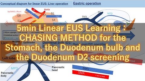 【CHASING METHOD】Linear EUS screening in the stomach, D1 and D2