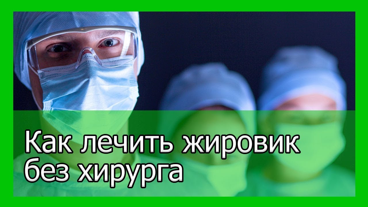 Как лечить жировик без хирурга - YouTube