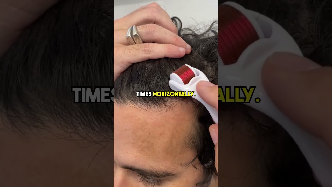 How To Use The Derma Roller For Hair Loss