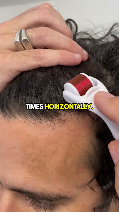 How to use the Derma Roller for Hair Loss