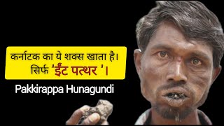 सरफ ईट पतथर खत ह य करनटक क शकस Pakkirappa Hunagundi. Man Addicted To Eat Bricks,Stones.