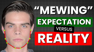 What They Didn’t Tell You About Mewing