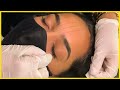 Mapeamento Facial Com Linha - Vem Conferir Essa Linda Marcação