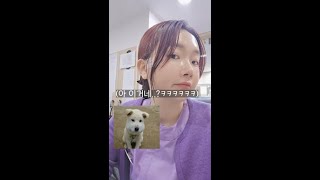 핀제거수술후 첫째날입니다..🙂
