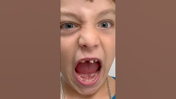 Oliver en Lucas trekken een losse tand 🦷 Het verliezen van een melktand #educatievevideo