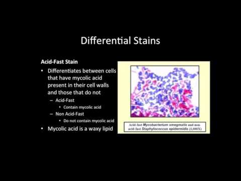 Differential Stains Definition