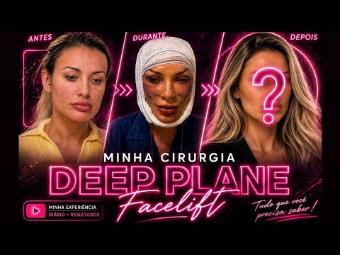 Deep Plane Facelift and all the other surgeries I had at the same time!!! Andressa Urach