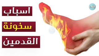 سخونة القدمين اسبابها وعلاجها