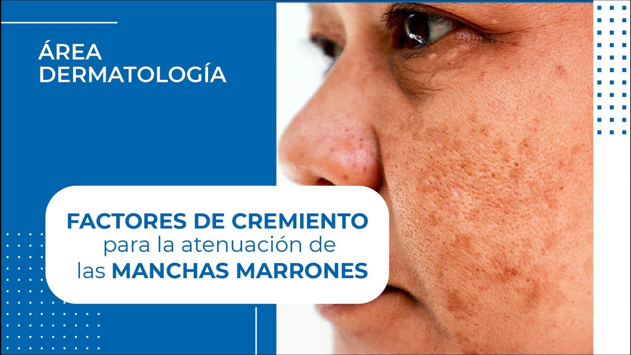 botox meaning Factores de crecimiento para manchas en la piel