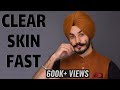 CLEAR SKIN FAST |  FACE SKIN TRANSFORMATION 2020