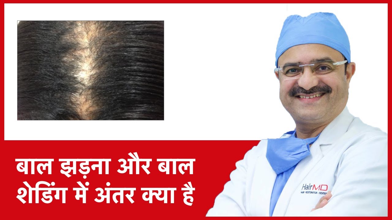 Discover more than 83 balding hair meaning in hindi latest in.eteachers