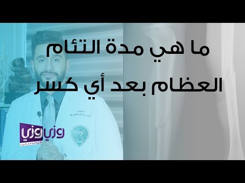 ما هي مدة التئام العظام بعد أي كسر