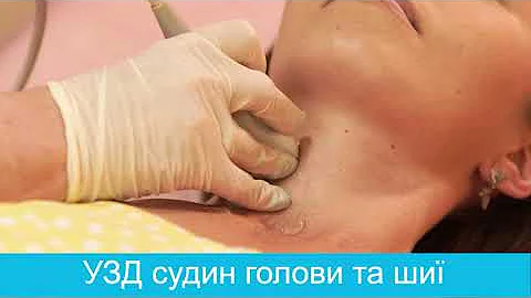 УЗИ сосудов головы и шеи