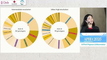 Clinical implementation of HLA long-read sequencing