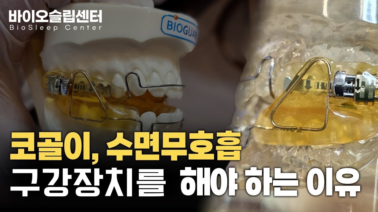 코골이와 수면무호흡 해결, 구강장치를 해야 하는 이유 - YouTube
