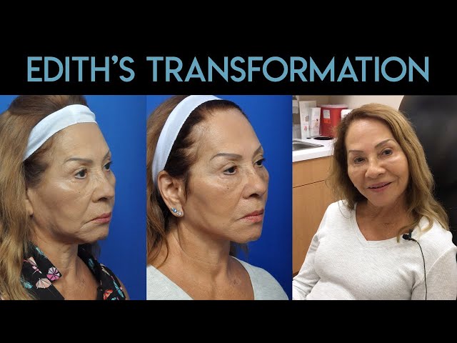 Edith's Transformation