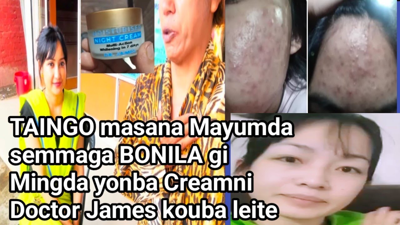 BONILA cream natte TAINGO na mayumda semba Cream ni 
