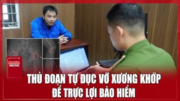 Triệt phá đường dây tự đục vỡ xương khớp, gây thương tích giả để trục lợi bảo hiểm