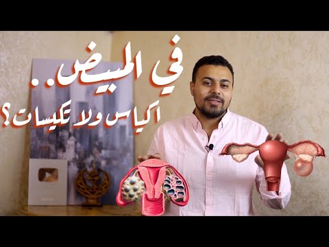 فيديو: 3 طرق لعلاج كيسات المبيض