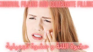 Gingival filling and Composite filling حشوة اللثة و حشوة تجميلية