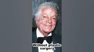 Michael Jackson Without Plastic Surgery Shorts Funny Memes 