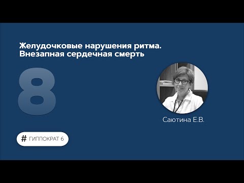 Желудочковые нарушения ритма. Внезапная сердечная смерть. 15.02.23