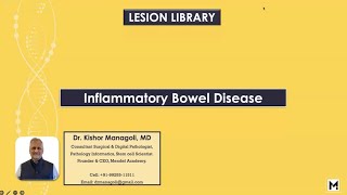 Inflammatory Bowel Disease (IBD): A Comprehensive Webinar