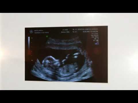 how-to-get-pregnant-complete-guide