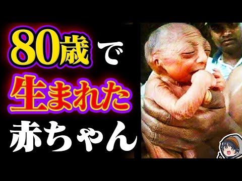 生まれた時から80歳の赤ちゃん