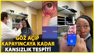 Türk Hekimden Çığır Açacak Buluş Kansızlığı Kan Almadan, Hastanın Gözünden Anlayan Uygulama