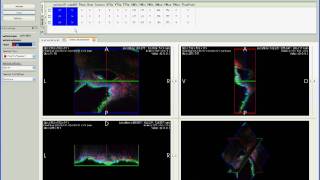 GoFigure2 tutorial Manual Segmentation