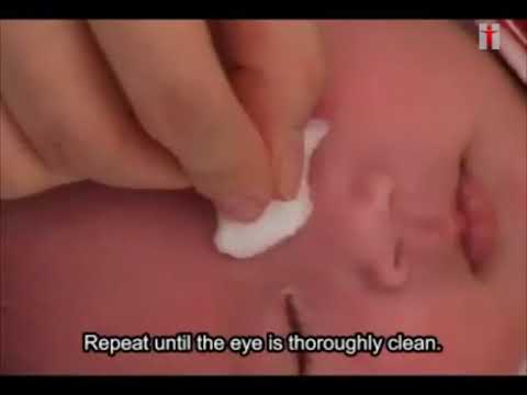 Cara membersihkan mata bayi Anda - English