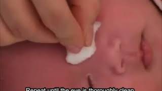 How to clean your baby's eyes - English
