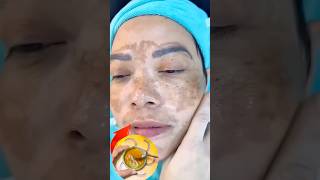 Tighten Wrinkles &amp; Remove Pigmentation forFlawless Glass Skin#naturalglow #facialcare #foryou