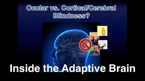 Inside the Adaptive Brain