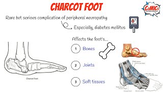 CoMICs Episode 63: Charcot foot
