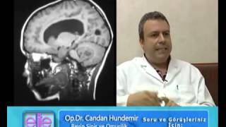 Op Dr Candan Hundemi̇r Beyi̇n Tümörü Sinir Tv Sağlık Video Nöropsikiyatri Video Psikiyatri Vid